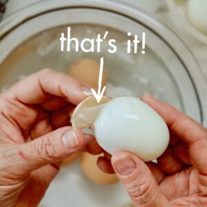 thats the membrane